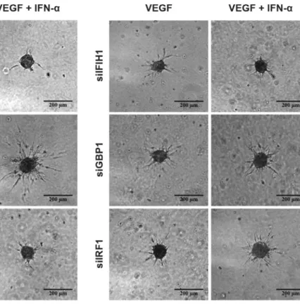 Fig. 4. Modulation of STAT1, USP18, IFIH1, GBP1, and IRF1 affects in vitro EC sprouting
