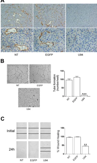 Figure 8: U94 inhibits tumor-driven angiogenesis. (A) CD31 immunostaining of tumor biopsies (original magnification: 20x upper 