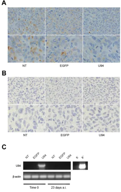 Figure 7: U94 induces MET of xenografted tumor cells.   Five  μm  thick  sections  were  prepared  and  stained  with  antibodies  against  (A) vimentin and (B) E-cadherin (Original magnification: 20x upper panels; 40x lower panels)