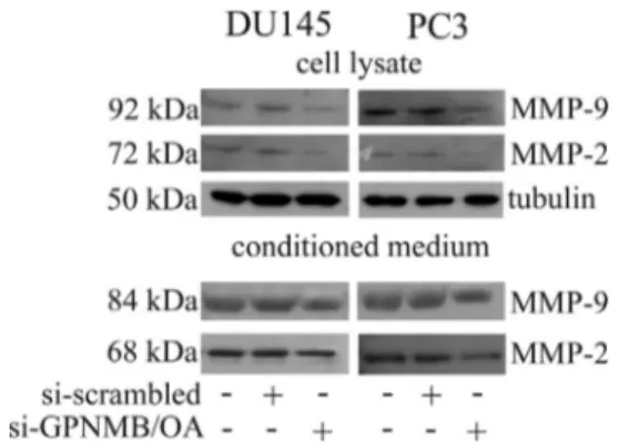 Fig. 4 – Effect of GPNMB/OA silencing on metalloproteinase MMP-2 and MMP-9 expression in DU145 and PC3 cells