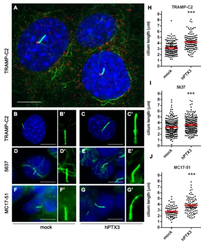 Figure 5. PTX3 overexpression  increases primary cilium length in different tumor cell lines