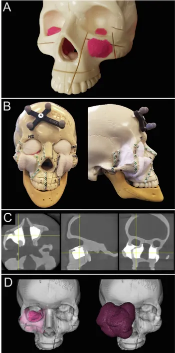 Fig. 1. Tumor models and imaging. A. Moldable material and acrylic glue were