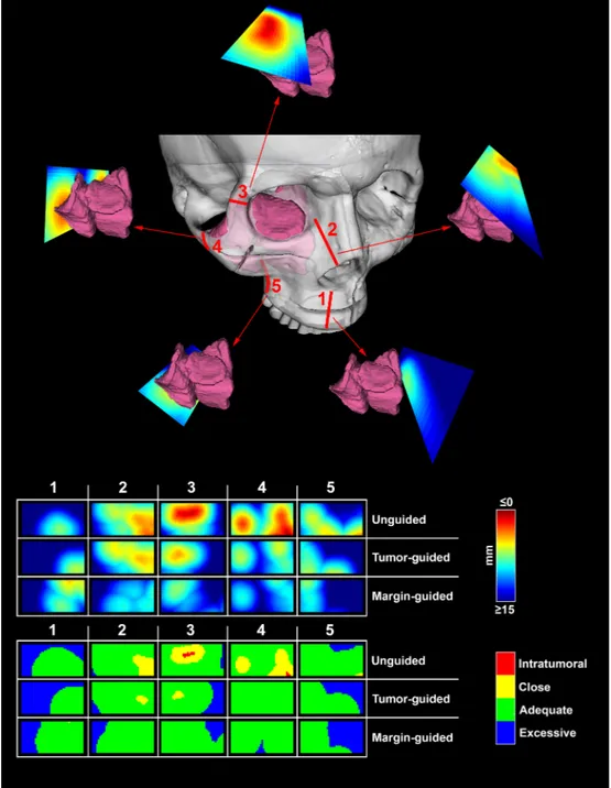 Fig. 5. Data generation. The upper part of the panel shows the sequence of 5 cut simulations around the tumor model