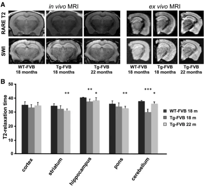 Fig. 3. Iron accumulation in whole brain of FVB mutated mice. A MRI brain examination of 18 and 22 month-old controls and transgenic FVB mice