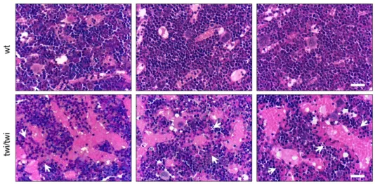 Figure 1. Abnormal BM vasculature in twitcher mice. H&amp;E staining of femurs from three wt and three  twitcher (twi/twi) mice