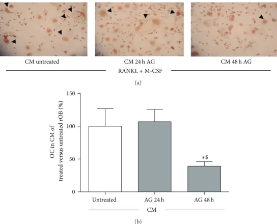 Figure 7: Effect of conditioned media (CM) obtained from rat osteoblast-like cells (rOB) treated without or with ghrelin (AG, 10 −10 M for 24 or 48 h) on osteoclast formation, in presence of 50 ng/mL RANKL and 25 ng/mL M-CSF