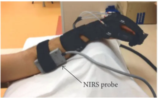 Figure 1: Experimental setup. The Gloreha glove was applied on the paretic hand. The NIRS probe (grey box) was applied over the forearm ventrolateral surface.