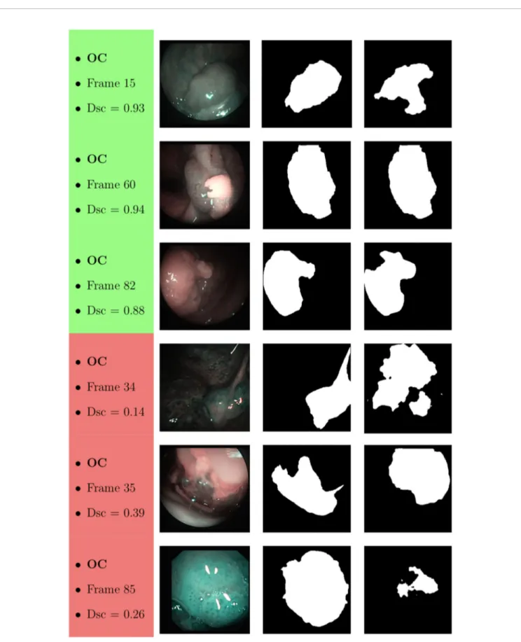 FIGURE 10 | Sample of original OC frames, manual masks, and relative predicted masks for ResNet with 5 (x2) blocks and 16 ﬁlters