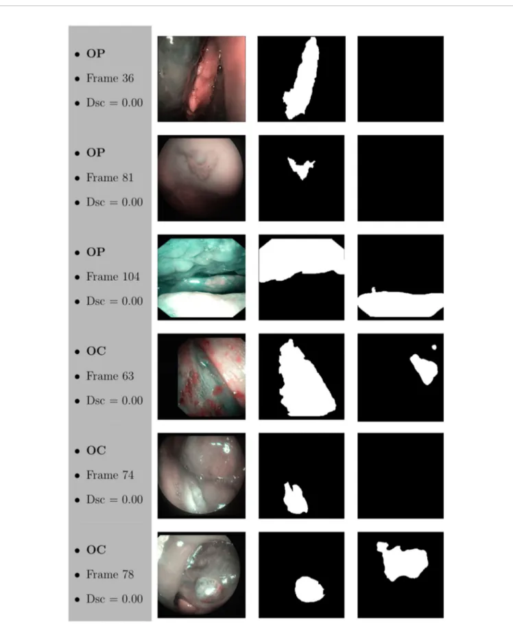 FIGURE 12 | Sample of original frames excluded from the boxplot comparisons due to their Dsc less than 5% (Dsc &lt;0.05) assessed by ResNet with 4 (x2) blocks and 16 ﬁlters for OP frames, and ResNet with 5 (x2) blocks and 16 ﬁlters for OC frames