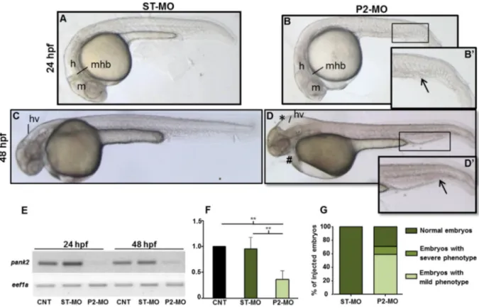 Fig. 2. Effects of pank2 morpholino during zebraﬁsh development. Standard (ST-MO) and pank2 morpholino (P2-MO) were micro-injected at 1/2-cell stage (1 pmol/embryo) and the phe- phe-notype observed at 24 and 48 hpf