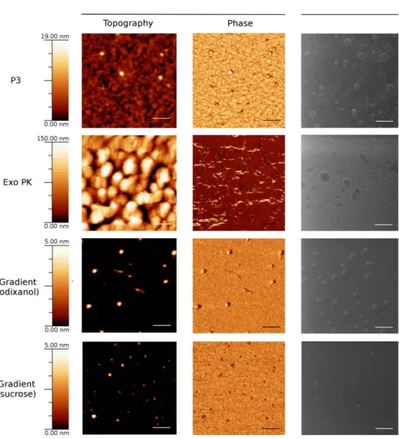 Figure 5.  Imaging of exosome preparations: exosome preparations were obtained from 1 mL MM pool  with four different protocols