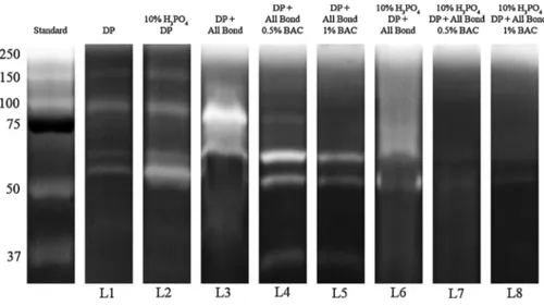 Fig. 1. Zymographic analysis of proteins extracted from dentin powder. Std: Standards (Std); L1:  miner-alized dentin (DP) showing the presence of activity of pro-form of 9 (92 kDa) and active form of  MMP-2 (66 kDa); L2: demineralized dentin powder (DDP) 