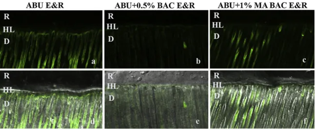 Fig. 5. Resin-bonded radicular dentin interfaces prepared with ABU SE (a,d), ABU + 0.5% BAC SE (b,e) and ABU + 1% methacrylate BAC SE (c,f) at T12 months, incubated with quenched ﬂuorescein-labeled gelatin