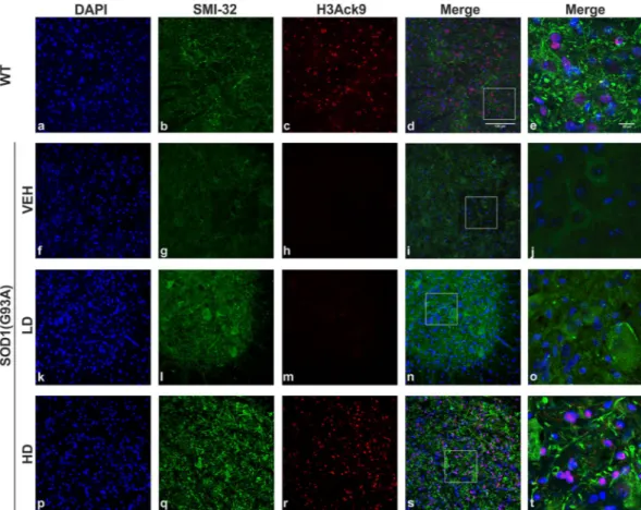 Figure 5.  Histone 3 acetylation in the lumbar spinal cord of WT and SOD1(G93A) mice. The figure panel 