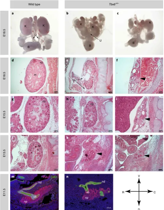 Fig. 3 | Analysis of urinary tract phenotypes in Tbx6 rv/–  mutants. a–c, Whole mounts of urogenital tracts
