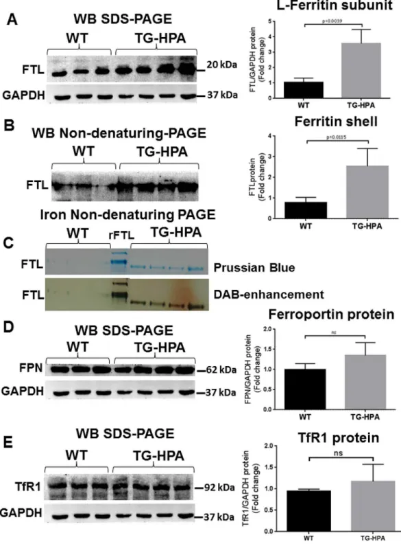 Fig 6. Transgenic mice overexpressing heparanase have increased ferritin-iron and ferritin protein content in the liver
