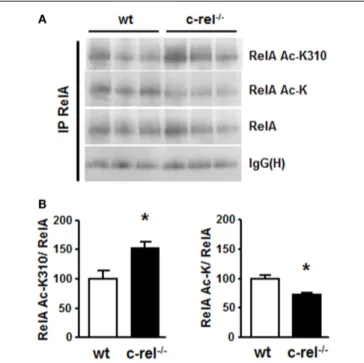 FIGURE 2 | RelA acetylation in the striatum of c-rel −/− and wt mice. (A) Representative picture of the immunoprecipitation analysis of RelA acetylation in total proteins of caudatus putamen