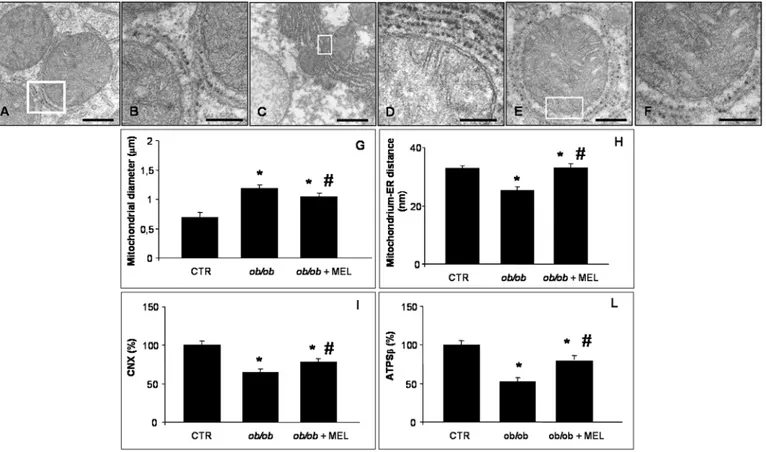 Fig 3. Hepatic mitochondria and endoplasmic reticulum. Transmission electron microscopy photomicrographs of lean (A, B), ob/ob (C, D) and ob/ob treated with melatonin mice (E, F) showed hepatic mitochondria and endoplasmic reticulum in all experimental gro