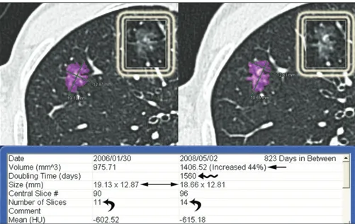 Figure 2. Example of the 3D analysis provided by the semiautomatic software in AIS presenting 