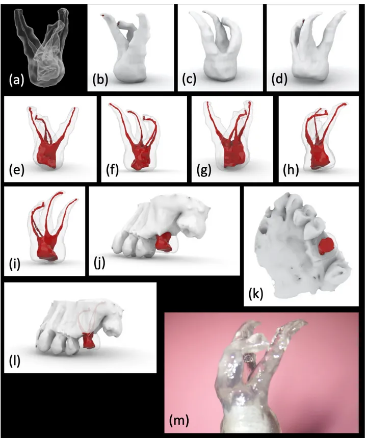 Figure 7. (a–l) CBCT data were uploaded to an STL software and (m) a transparent plastic model was three-dimensionally  printed
