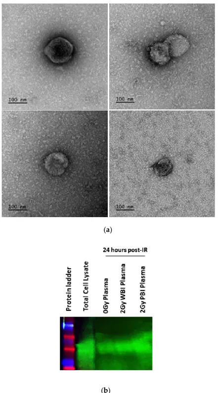 Figure 2. Confirmation of presence of exosomes. (a) TEM micrographs of exosomes. Representative  images  1:10  or  1:100  diluted  plasma  exosome  samples
