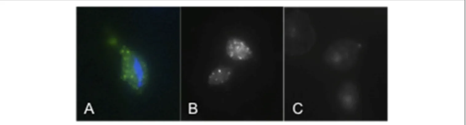 FIGURE 2 | TvSaplip12 localization in Trichomonas vaginalis cells. (A,B) Tvsaplip12 was detected by immunofluorescence microscopy after staining with an anti-TvSaplip12 monoclonal antibody (green)
