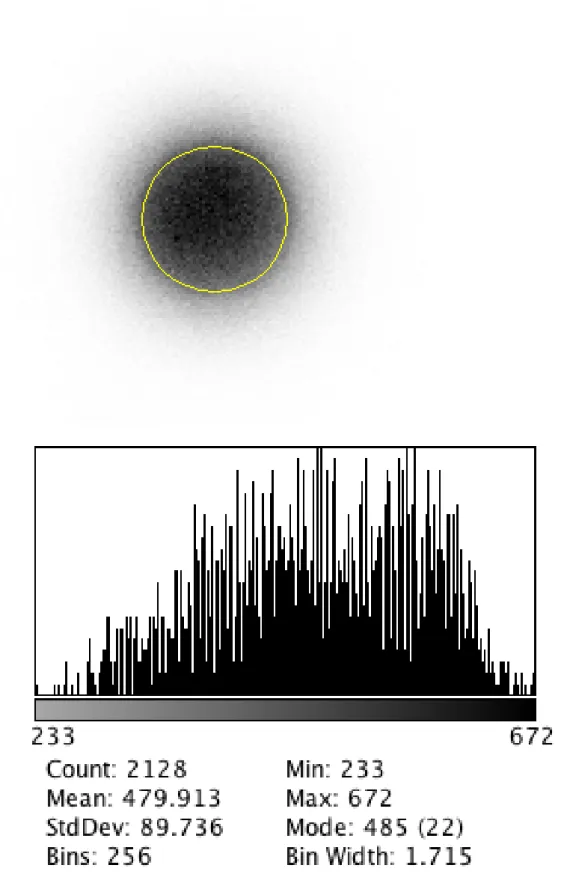Figure  4b:  Low  Energy  High  Resolution  scintigraphic  image  with  relative  geometric  distribution  analysis 