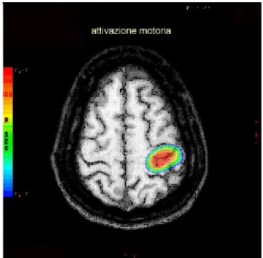 FIG: 4.1 – immagine ottenibile con fMRI 