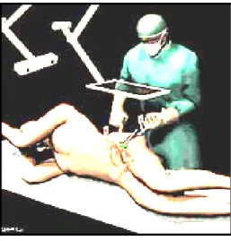 Figura 1 - 4: Simulazione di un intervento chirurgico attivo con Micron.