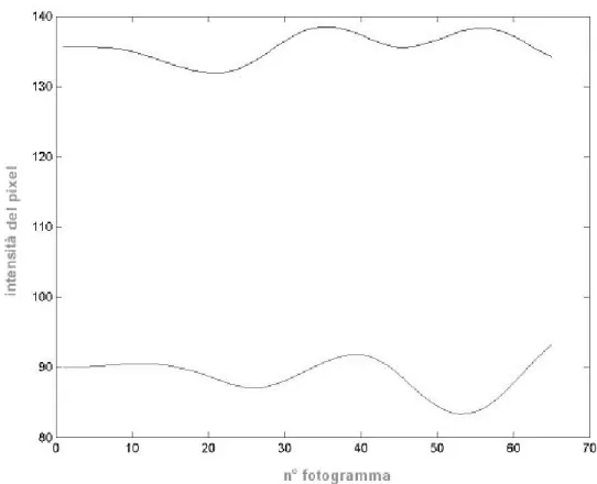 Fig 6- 10    Grafici del segnale intensità dopo le operazioni di filtraggio frequenziale: in basso è tracciato il  segnale relativo al vaso sanguigno selezionato; in alto quello “basale”, relativo alla media di una sezione  dell’epicardio non vascolarizzat