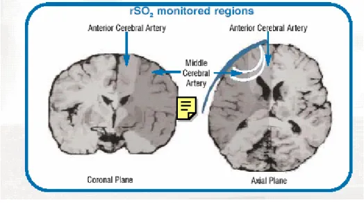 Fig 3.3-Regioni del cervello su cui si opera con l’invos della somanetics  