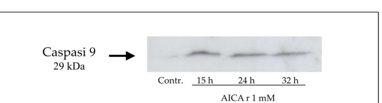 Figl 3l l  AIAAtAtribtifteAi iuztAtczbutitittutiiuAititu.  Immunobloting di estrati citosolici otenuti in colture incubate in presenza o assenza di AICA riboside per 15 orel  isultati simili sono otenuti in 3 esperimenti indipendentil 