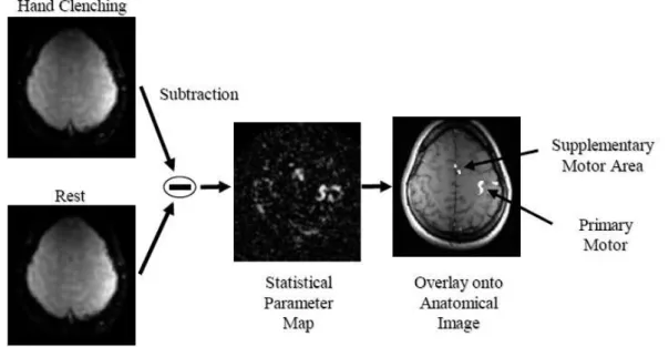 Figura 2: Esempio di metodologia sottrattiva, a sinistra si hanno le immagini relative a due   condizioni   diverse   necessarie   per   evidenziare   l’area   di   controllo   motorio   nel cervello