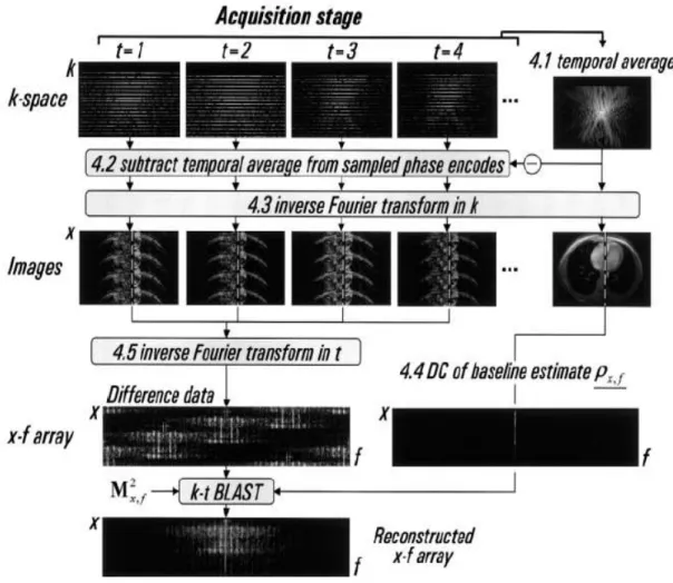 Figura 4.  Principali passaggi della fase di acquisizione per il metodo k-t BLAST. Tali