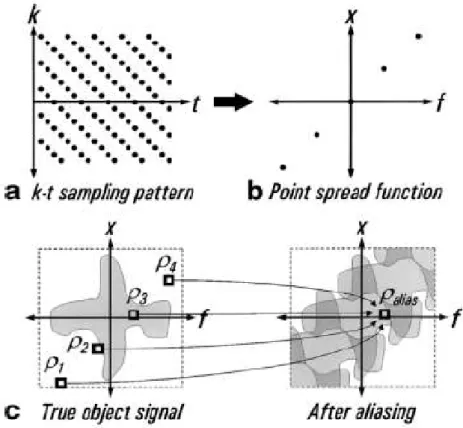 Figura 1. a: Piano di campionamento nello spazio k-t per un fattore di accelerazione di 4.