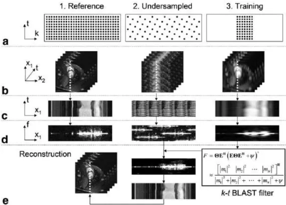 Figura 2: Processo di ricostruzione tramite K-t BLAST di una serie di immagini cardiache.[Rif.9] 