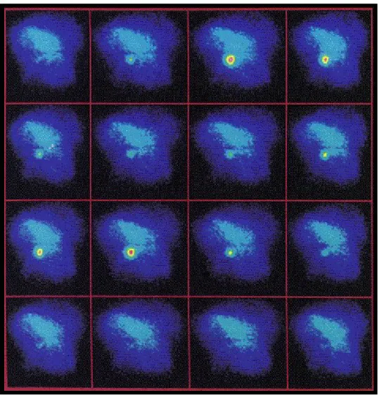 Fig 1.6 : Immagini di raggi X provenienti da Crab Nebula in un tempo di esposizione di 5 ore,                 pari ad un intero ciclo della pulsar