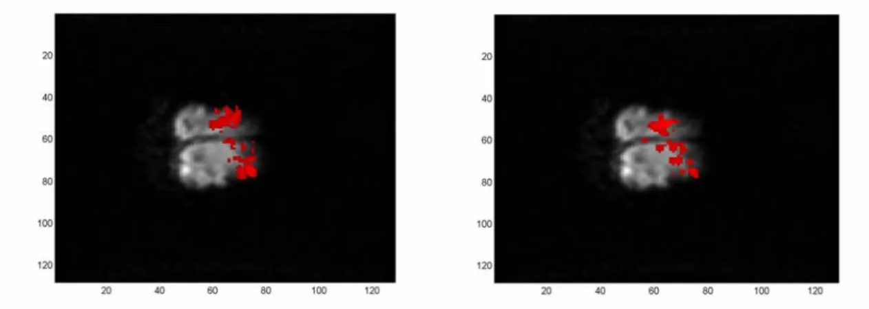 Fig. 6.1    Mappe di attivazione ottenute per regressione lineare sfruttando due risposte fMRI  stimate sfasate di 3 sec