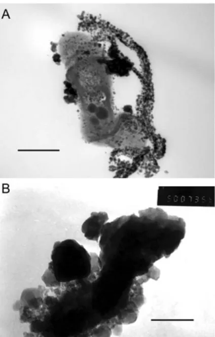 Fig. 1 A: A TEM micrograph of a BAS-10 strain producing an