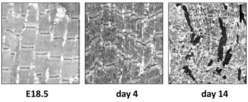 Figure  9-  Z-disk  alterations,  degenerated  myofibrils,  and  apoptotic  nuclei  in  muscle  of  bag3  -/-  mice