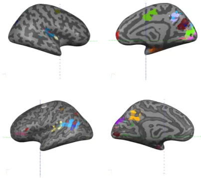 Figure 2.7: The highlighted areas correspond to the top 10% more discriminative clusters according to Random Forest on an inated representation of the cortex (right hemisphere on top row and left hemisphere on bottom row).