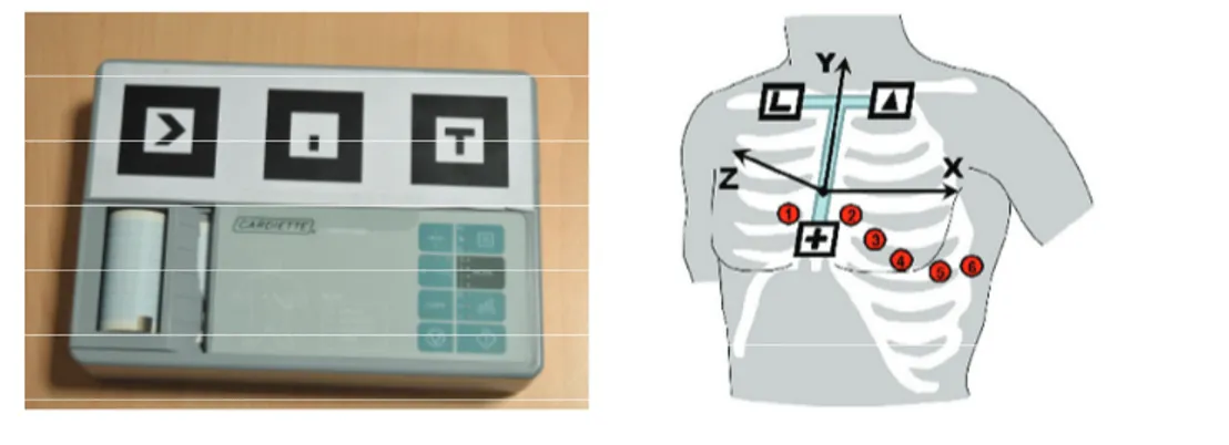 Figure 3.5: The constellations of markers used to detect and track the point of view of the user while working with the ECG device (left) and while placing the