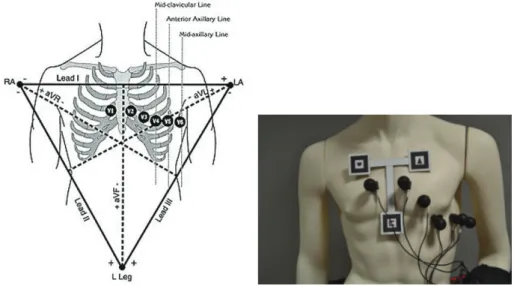 Figure 3.6: The Einthoven triangle (left) and the markerset arranged on a T- T-Structure specifically designed for the case study.