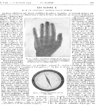 Fig.  40  Guillame, “Les rayons X  de  M. le  professeur Wilhelm Conrad Röntgen”,  La Na-