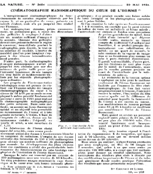 Fig.  38      Comandon,  Lomon, Cinématographie  radiographique  du  cœur  de  l’homme,  La 