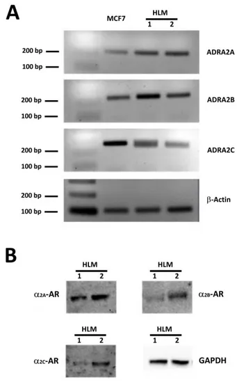 Figure 1. ADRA2A, ADRA2B, ADRA2C expression in HLMs.