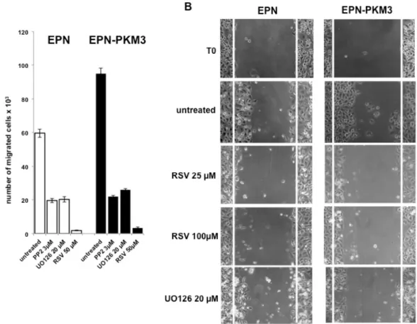 Fig. 2. RSV inhibits migration of epithelial prostate cells. A) EPN and EPN-PKM3 cells were serum starved for 48 h