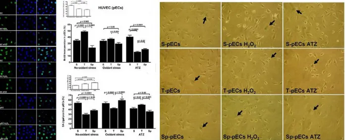 Figure 2. Proliferation rate by BrdU staining (panel on the left) and senescence levels by ß-Gal assay (panel on the right)  in primary endothelial cells (HUVEC) conditioned with sera from athletes practicing aerobic (thriatlon, T), mixed  (soccer, S) and 