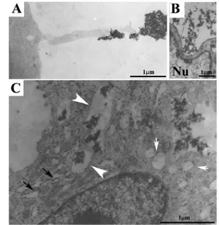 Fig. 4. A: the cell in the micrograph presents both a ruffled border  at the left and large vesicles of undegraded CaP/type I collagen (black  arrows) which we have found also in cells that has no ruffled border and 