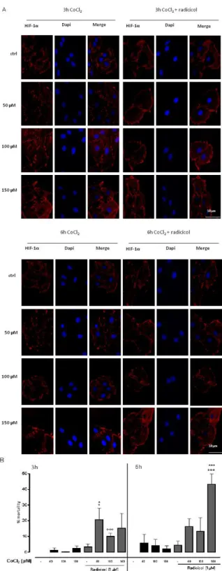 Figure 8:  CoCl 2  induces hypoxic state. CoCl 2  (50-100-150µM) was administered  for 3 and 6 h and H9c2 cells were stained with HIF-1α (red) and nucleus with DAPI  (blue) and were determined by Immunofluorescence analysis